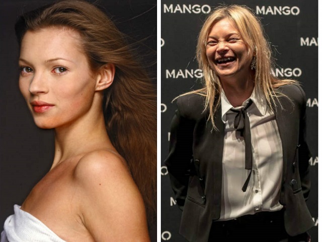 Kate Moss và hành trình tự hủy hoại nhan sắc