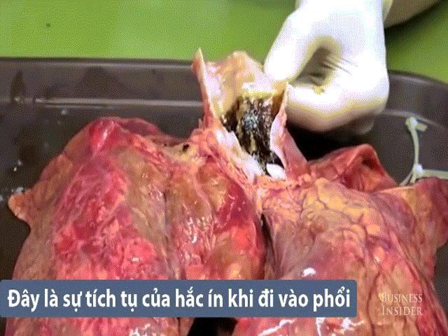 Phổi của bạn trông như thế nào sau khi hút 20 điếu thuốc lá?