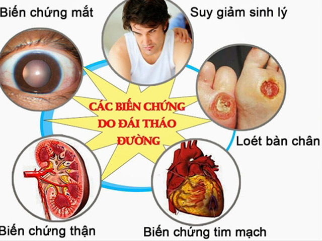 Bác sĩ BV Bạch Mai chỉ ra những sai lầm người đái tháo đường hay mắc phải