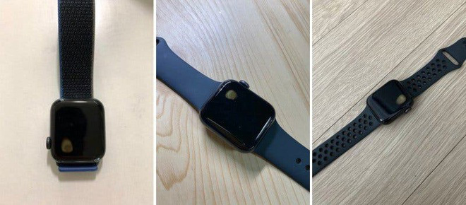 Apple Watch quá nhiệt gây bỏng tay người dùng - Ảnh 3.