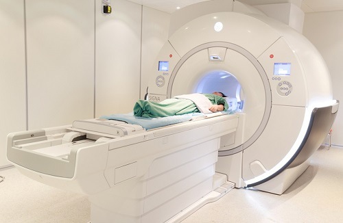 Đột quỵ não và vai trò của chụp cộng hưởng từ (MRI) trong tầm soát đột quỵ - Ảnh 5.