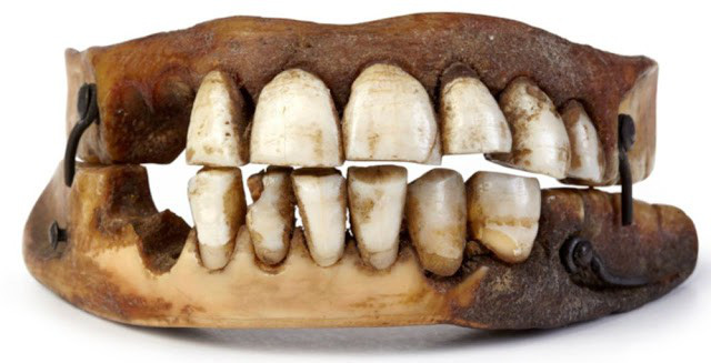 Hoảng hồn mục đích người xưa khi lấy răng của binh lính tử trận - Ảnh 4.