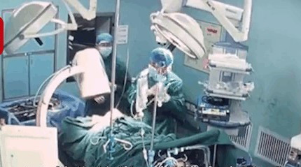Quá phi thường, bác sĩ bị chấn thương gẫy xương sườn vẫn phẫu thuật thành công cho bệnh nhân sau hơn 1 tiếng  - Ảnh 2.