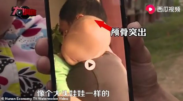 Trung Quốc điều tra nghi vấn sữa giả làm trẻ sơ sinh to đầu - Ảnh 1.
