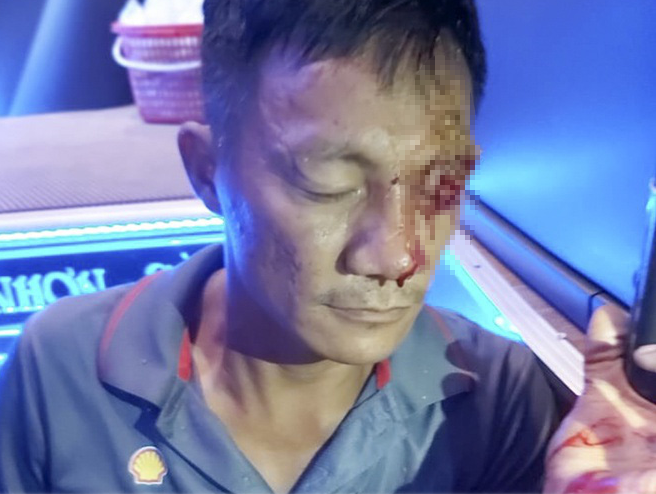 Nạn nhân kể phút kinh hoàng bị súng bắn ở bến xe trung tâm Quy Nhơn - Ảnh 1.