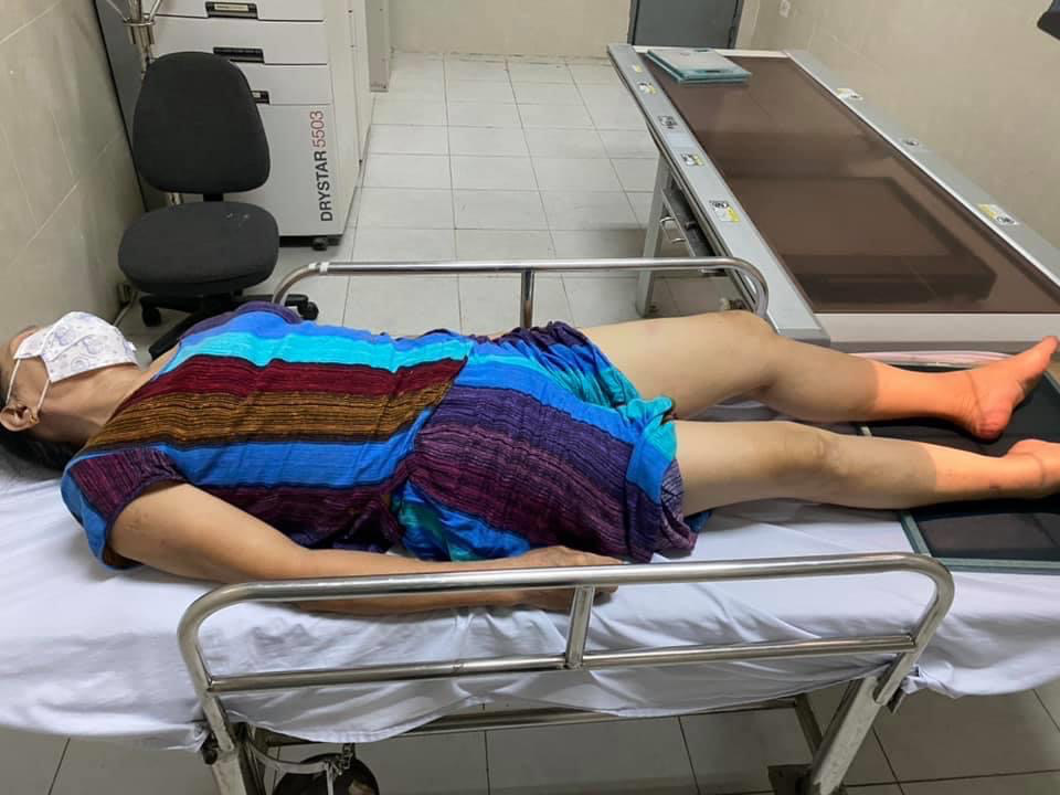 Hình ảnh 'giang hồ' Phú Lê bị còng tay đi vào bệnh viện Đức Giang - Ảnh 4.