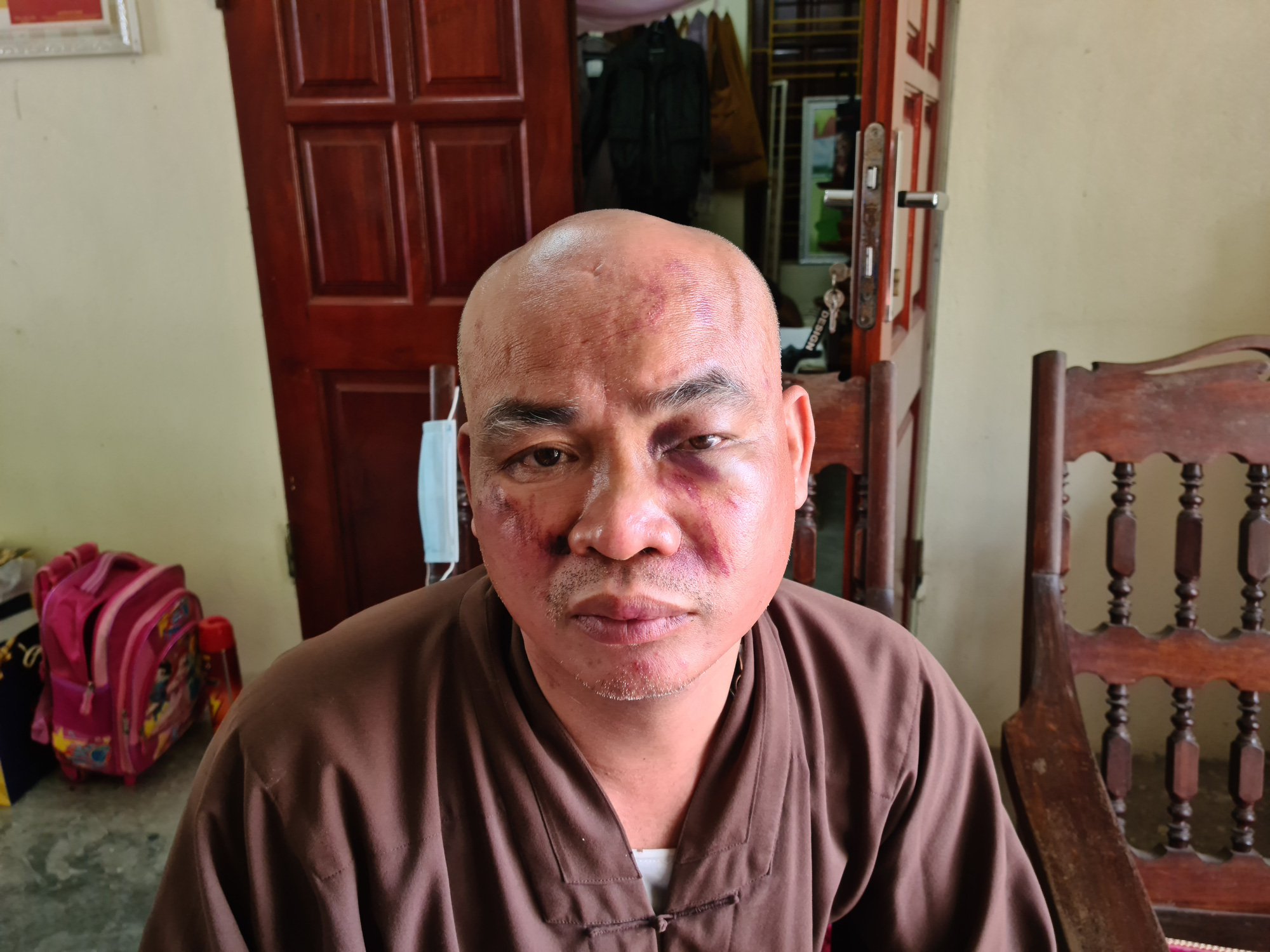 Hải Phòng: Sư chùa Thiên Mụ bị hành hung vỡ xương mũi - Ảnh 1.