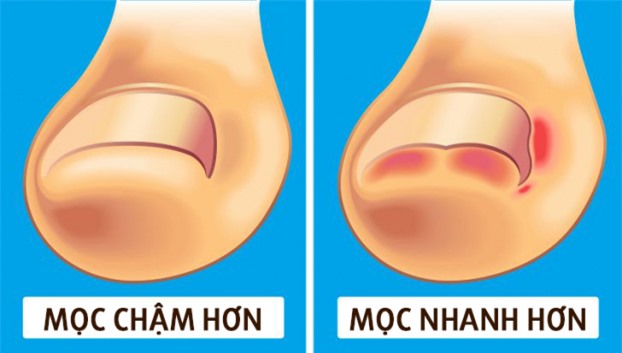 Vì sao móng tay mọc dài nhanh hơn móng chân? - Ảnh 5.