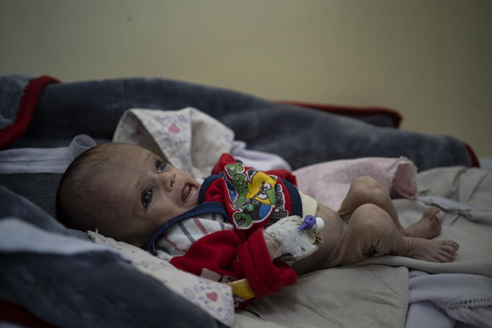Rơi nước mắt những đứa trẻ gầy trơ xương vì đói phải nhập viện cấp cứu ở Afghanistan - Ảnh 2.