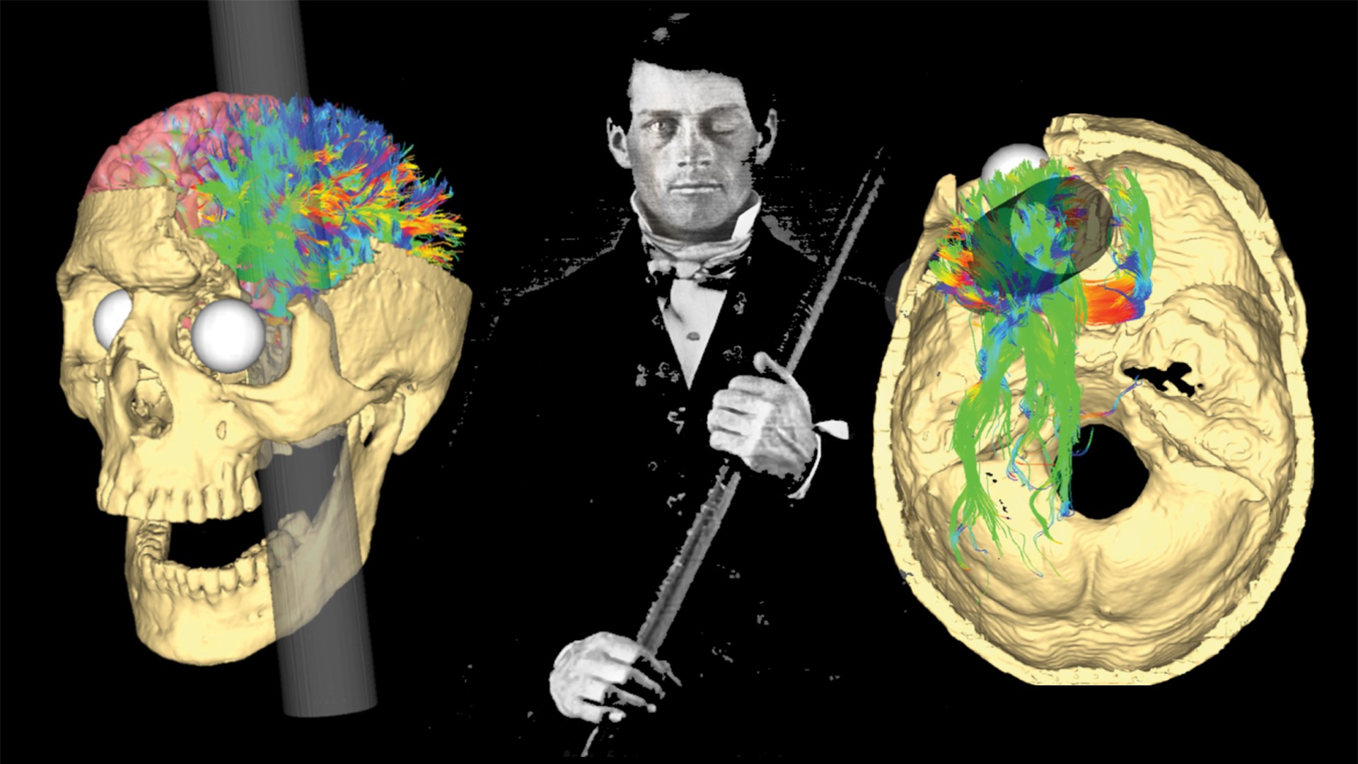 Phineas Gage và vụ tai nạn đã khai sinh ra khoa học thần kinh hiện đại - Ảnh 1.