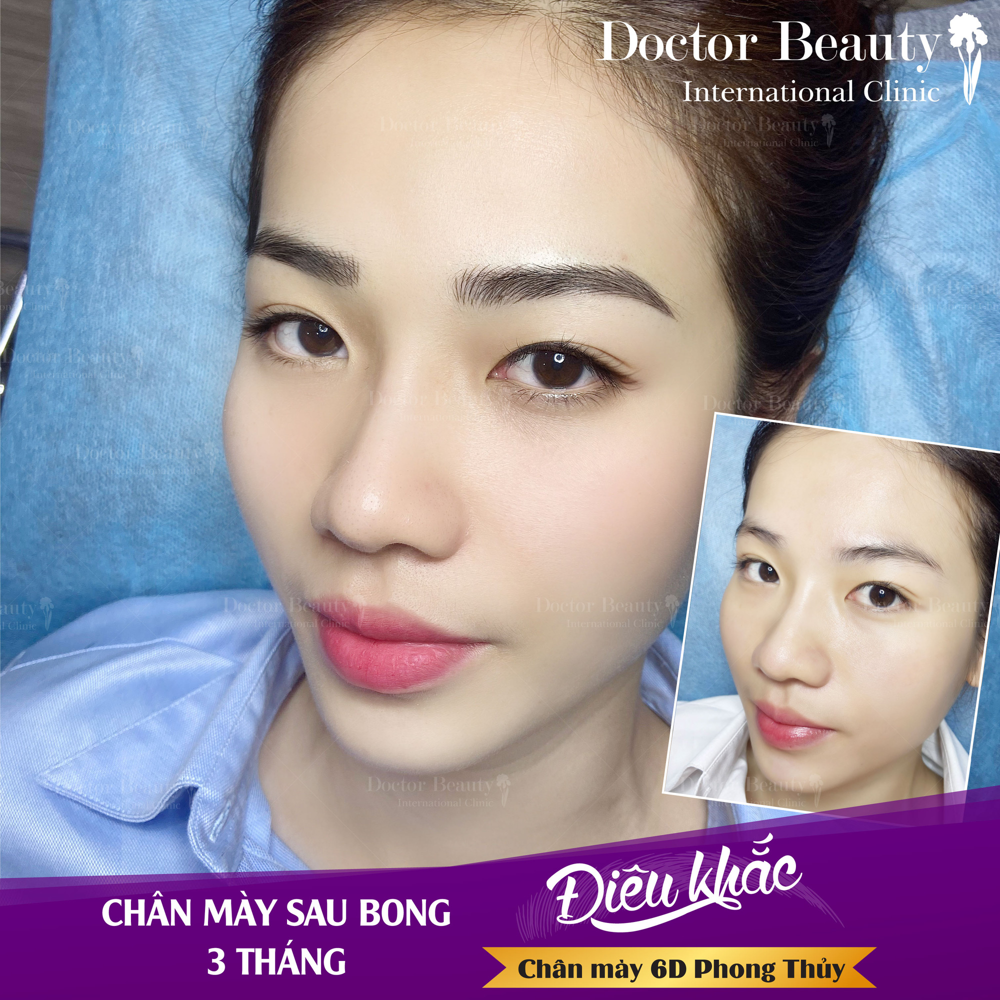 Doctor beauty international Clinic miễn phí xóa xăm chân mày - Ảnh 3.