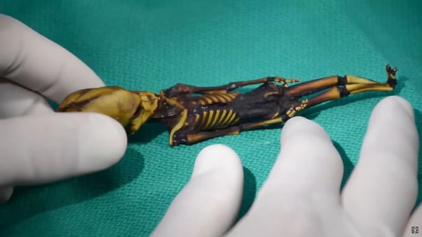 Bí ẩn về bộ xương kỳ lạ có đầu hình nón giống người ngoài hành tinh khiến giới khoa học sửng sốt - Ảnh 2.