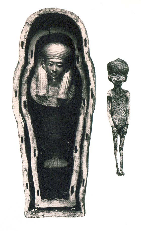 Sự thật chấn động 2 xác ướp bé gái hoàn hảo trong mộ Pharaoh Tutankhamun - Ảnh 9.