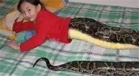 Bé gái 13 tuổi biến thành rắn con sau cơn sốt, bác sỹ bất lực bó tay trong việc chẩn đoán - Ảnh 8.
