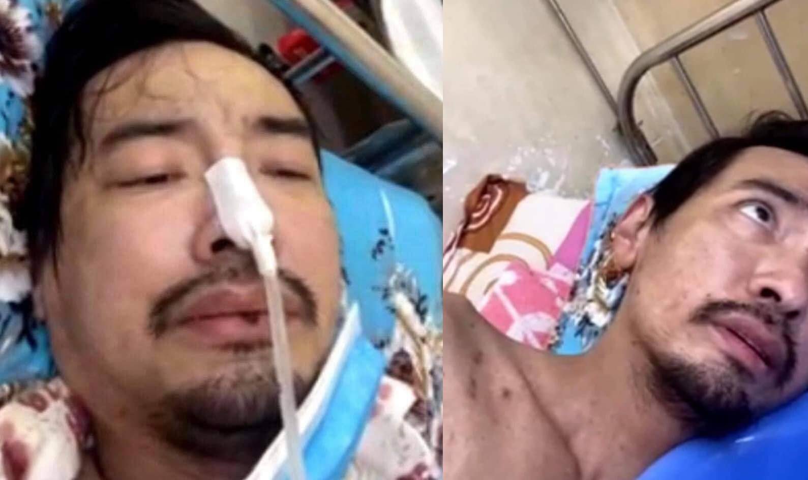 Ca sĩ Việt Quang bị viêm phổi nặng, đang điều trị tích cực - Ảnh 2.