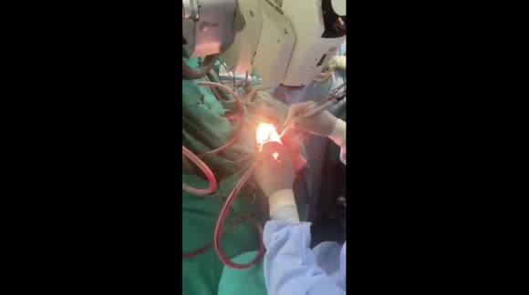 Video: Bác sĩ phẫu thuật não trong khi bệnh nhân đang tụng kinh khiến dân tình hoảng hốt - Ảnh 2.