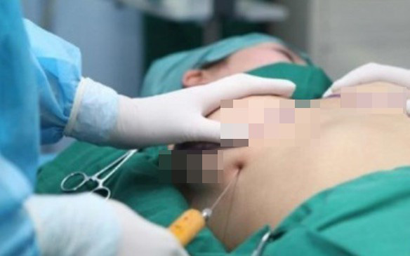 Bác sĩ chở thi thể cô gái tử vong khi nâng ngực từ TP.HCM về Trà Vinh mai táng khai báo gì?