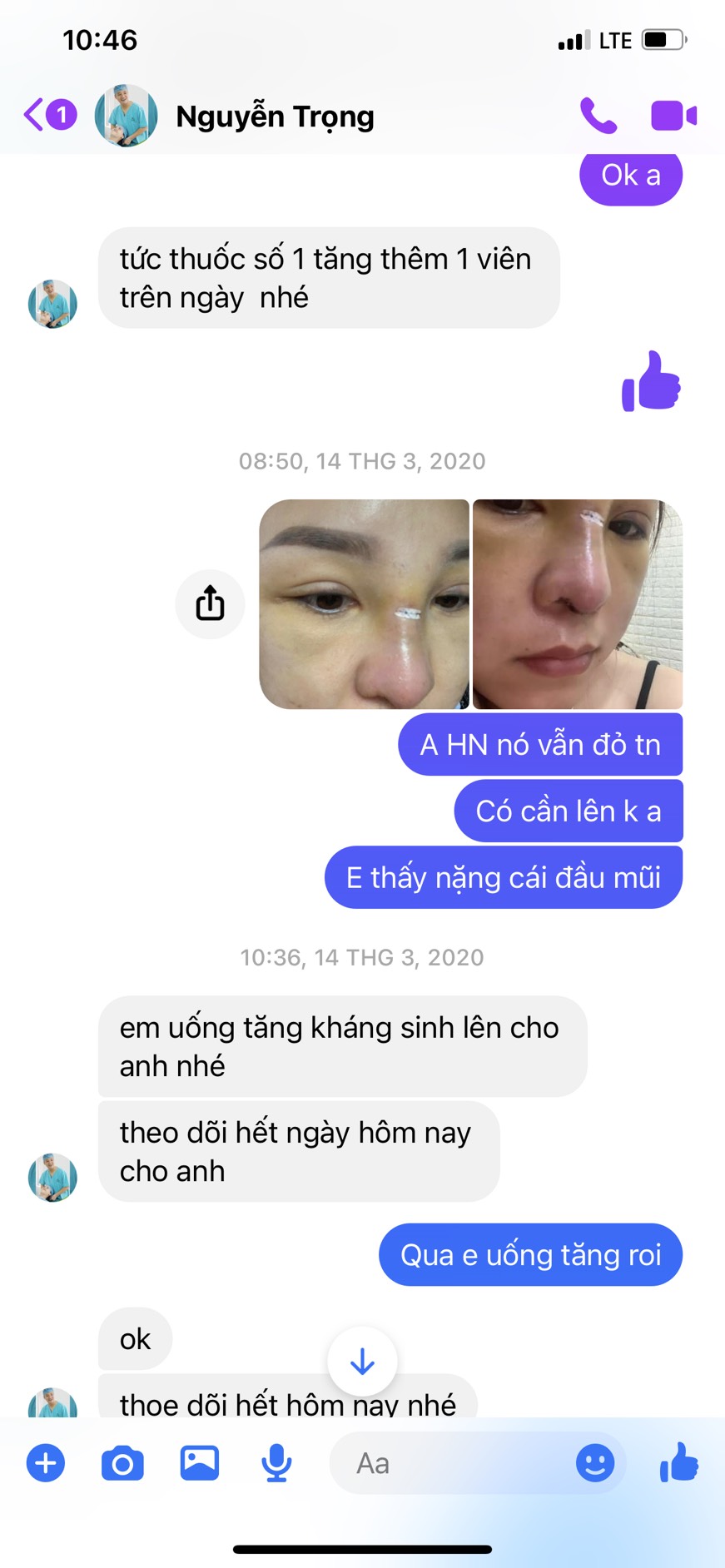 Khi thấy biến chứng chị H được trang facebook Đức Trọng tư vấn uống tăng cường thêm kháng sinh