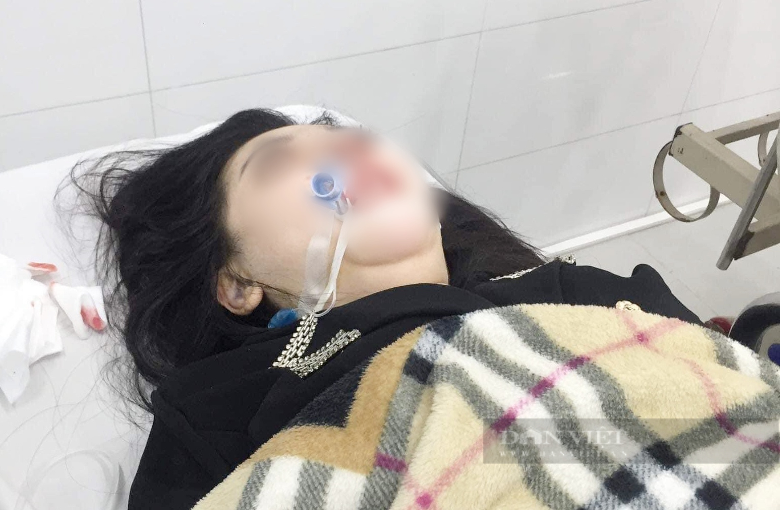Phẫu thuật nâng mũi tại cơ sở thẩm mỹ, cô gái 22 tuổi hôn mê, nhập viện cấp cứu  - Ảnh 2.