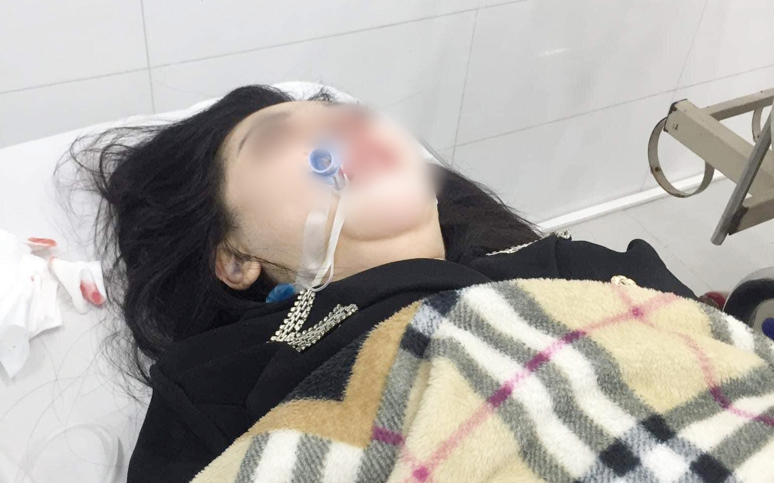 Phẫu thuật nâng mũi tại một cơ sở thẩm mỹ ở Hà Nội, cô gái 22 tuổi hôn mê, nguy kịch