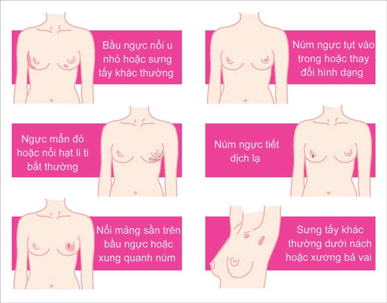 Mỗi năm Việt Nam có hơn 21.500 ca ung thư vú, có xu hướng trẻ hóa - Ảnh 2.