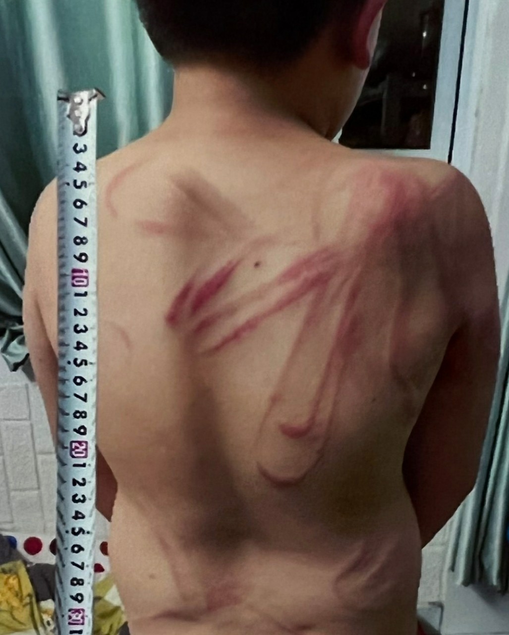 Vụ bố bạo hành con đẻ ở Đà Lạt: Tạm giam người bố 3 tháng - Ảnh 2.