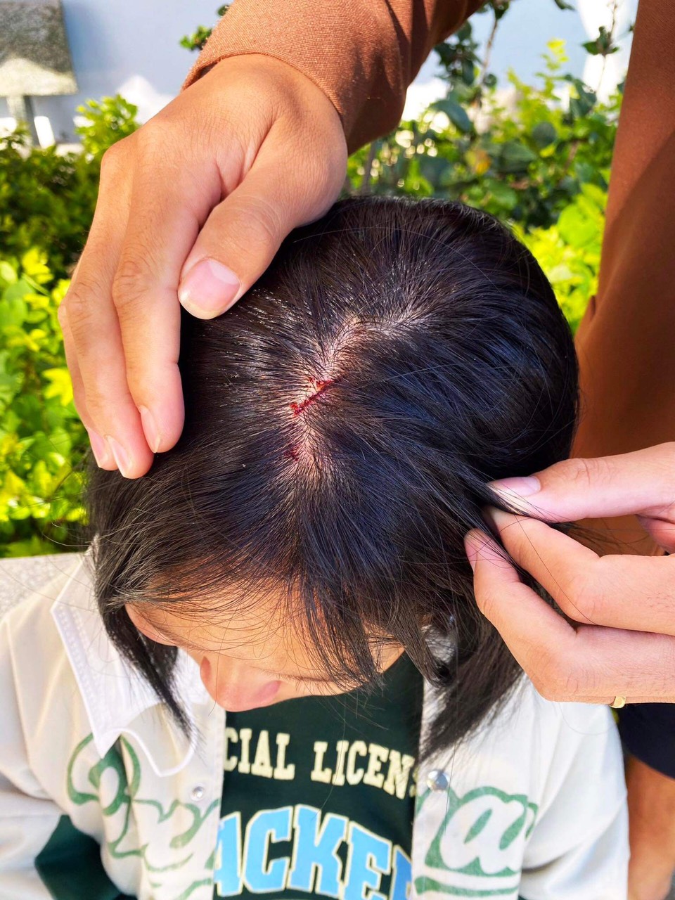 Nữ sinh lớp 7 bị đánh hội đồng ở Lâm Đồng, nhập viện trong tình trạng hoảng loạn  - Ảnh 3.