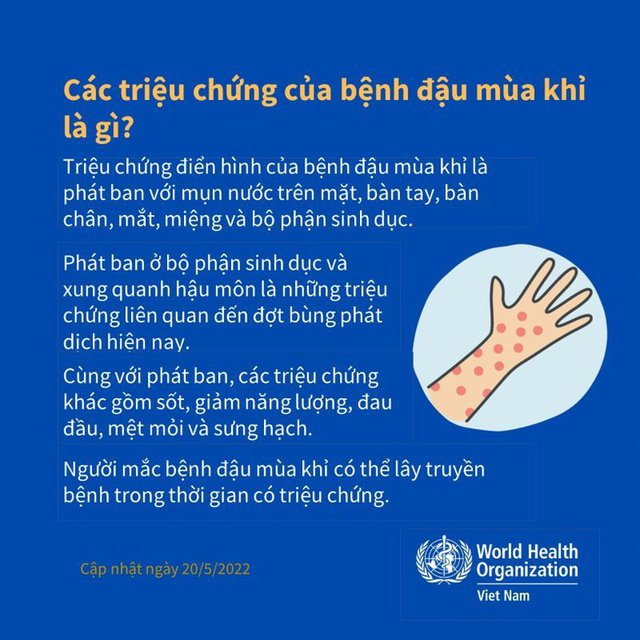 Khả năng lây nhiễm của ca bệnh đậu mùa khỉ ở Việt Nam thế nào?  - Ảnh 2.