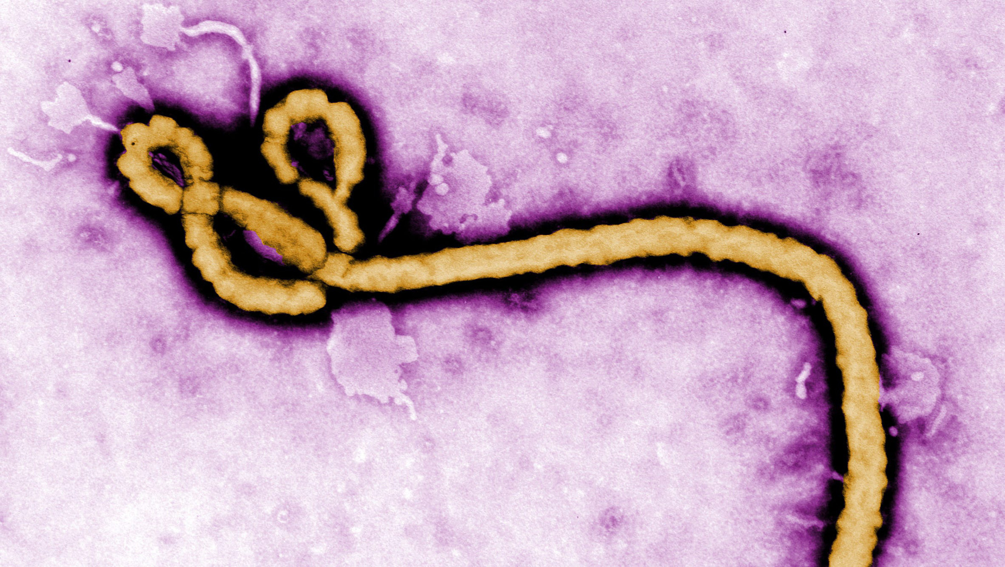 Virus Ebola có khả năng tồn tại trong não suốt nhiều năm liền - Ảnh 1.