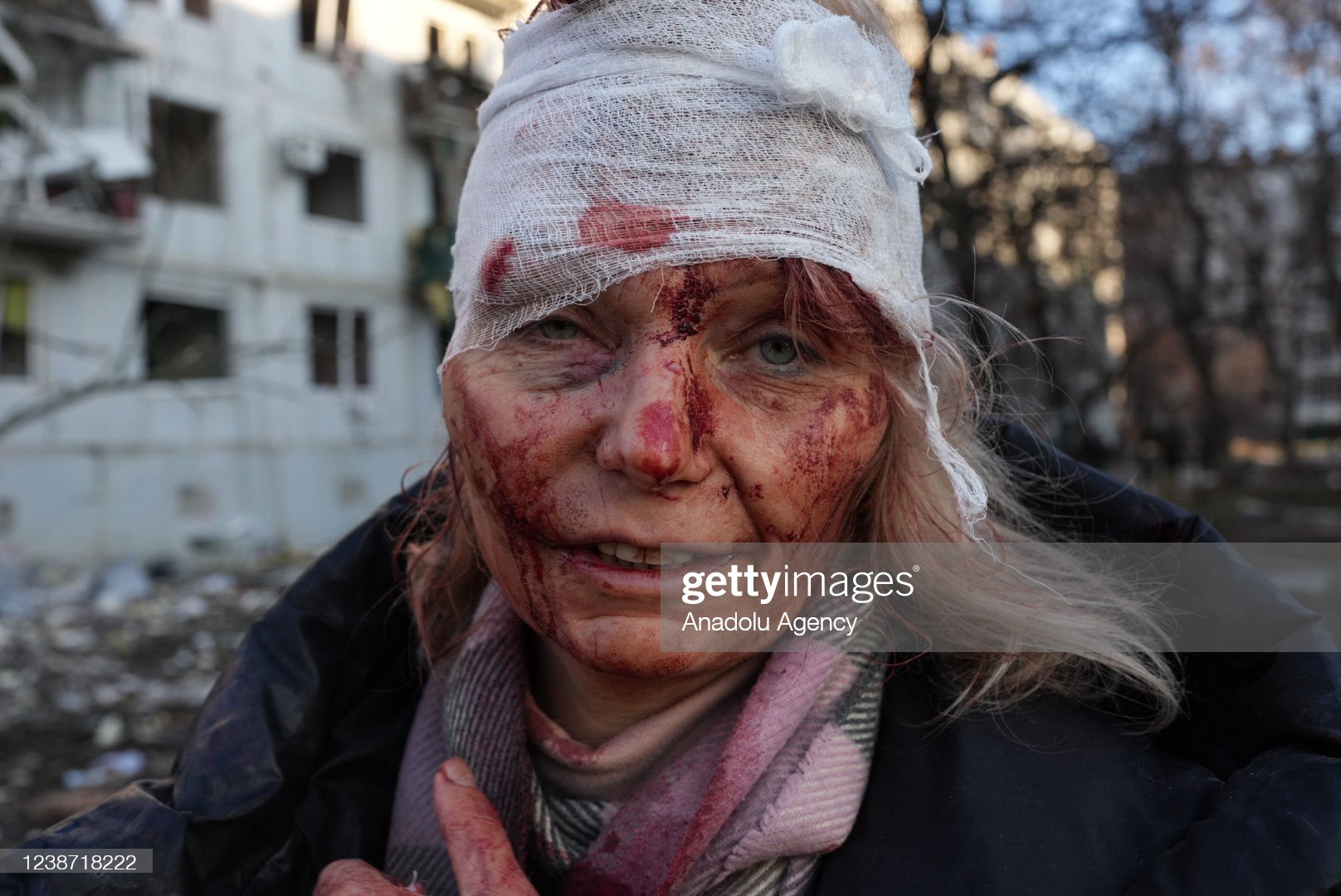 Những hình ảnh tang thương và loạn lạc tại Ukraine sau cuộc tấn công của Nga - Ảnh 3.