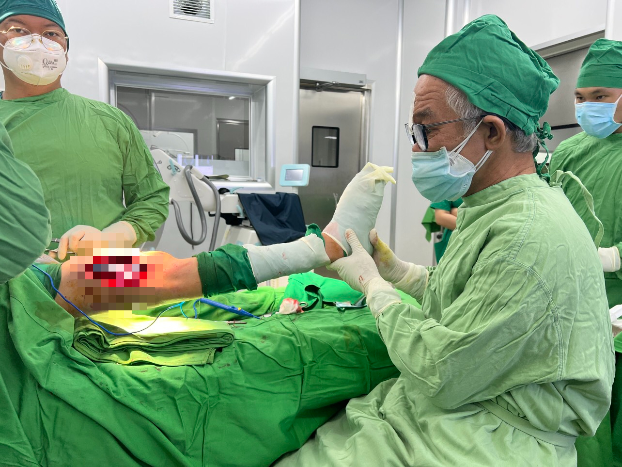 Khánh Hòa: Phẫu thuật thành công bệnh nhân chân bị cong vẹo, khập khiễng  - Ảnh 1.