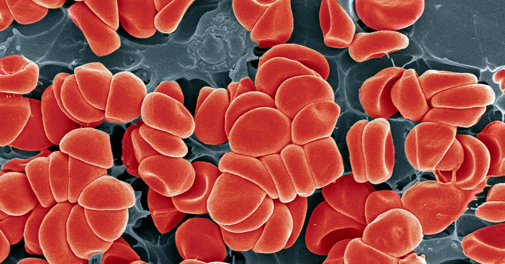 Risk of abnormal blood clotting after Covid-19