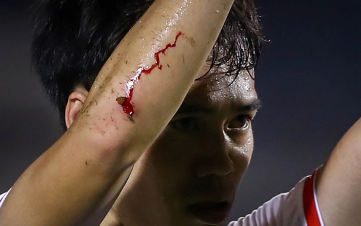 Văn Toàn: Cánh tay rớm máu trước Jeonbuk và thống kê "khủng"