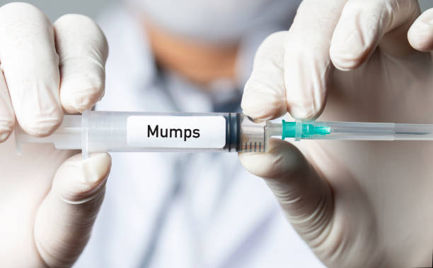 Beware of mumps in the elderly - Photo 2.
