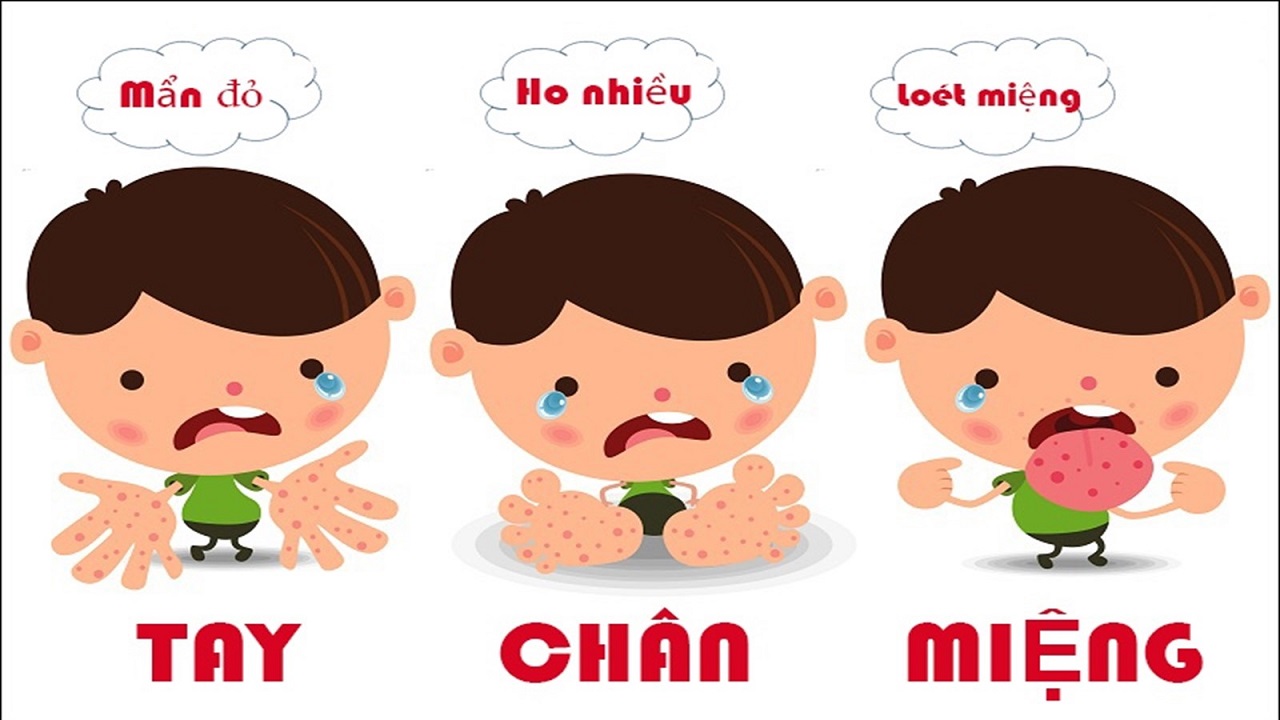 Cả nước có hơn 5.500 ca tay chân miệng, Bộ Y tế cảnh báo dịch gia tăng - Ảnh 1.