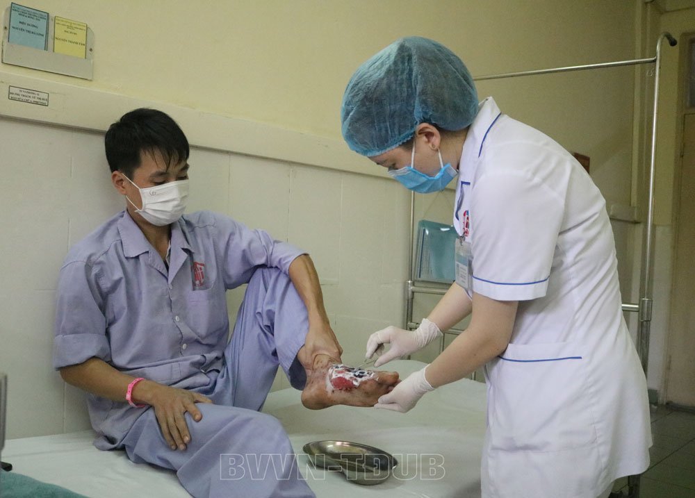 Using a healer's powder to treat burns, an infected male, two feet necrosis - Photo 1.