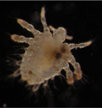 Rare: Nearly 100 pubic lice nest on the patient's male eyelid - Photo 2.