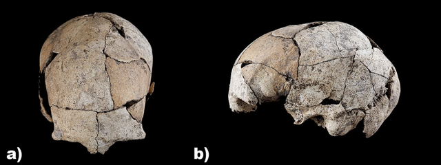 Ancient skull shows evidence of the first human ear surgery - Photo 1.