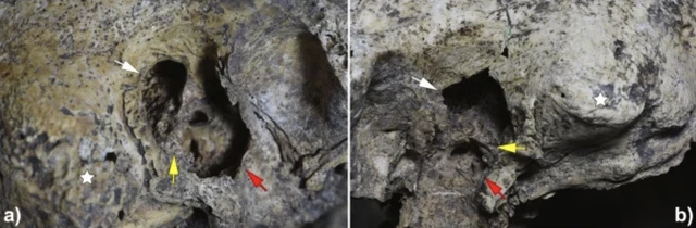 Ancient skull shows evidence of the first human ear surgery - Photo 2.
