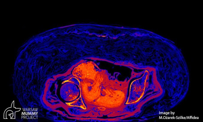Sốc với xác ướp chứa bào thai tại Ba Lan - Ảnh 2.