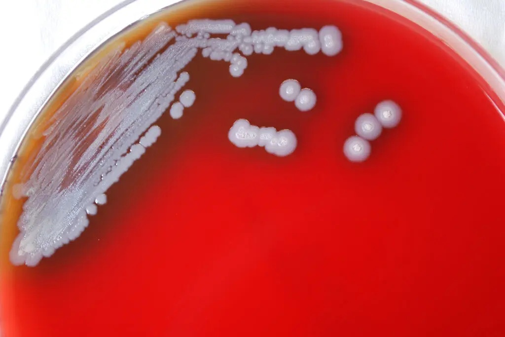 Mỹ lần đầu phát hiện 'vi khuẩn ăn thịt người' trong mẫu đất và nước - Ảnh 1.