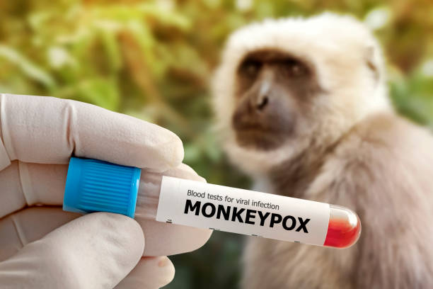 Hướng dẫn chẩn đoán, cách ly, điều trị bệnh đậu mùa khỉ ở người  - Ảnh 2.