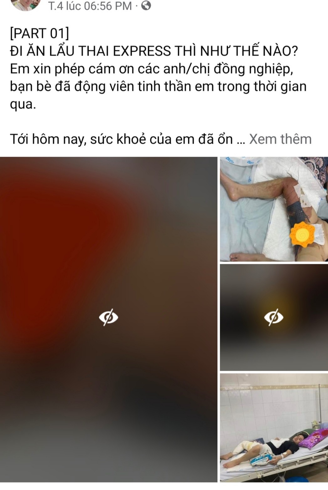 Nhân viên Thai Express bị tố đổ nguyên nồi lẩu vào người khách - Ảnh 1.