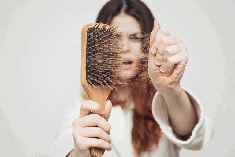7 nguyên nhân phổ biến gây rụng tóc - Ảnh 1.