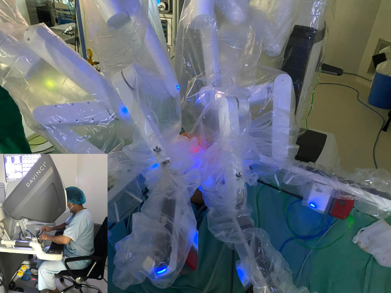 Phẫu thuật bằng robot, điều trị hiệu quả cho bệnh nhân ung thư thận - Ảnh 1.