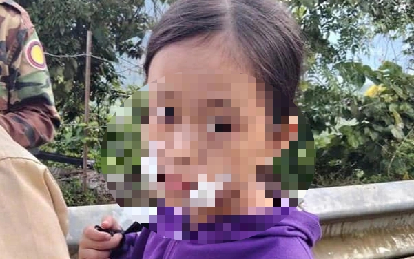 Bé gái 9 tuổi bán trái cây bên đường bị cướp tiền, chém nhập viện