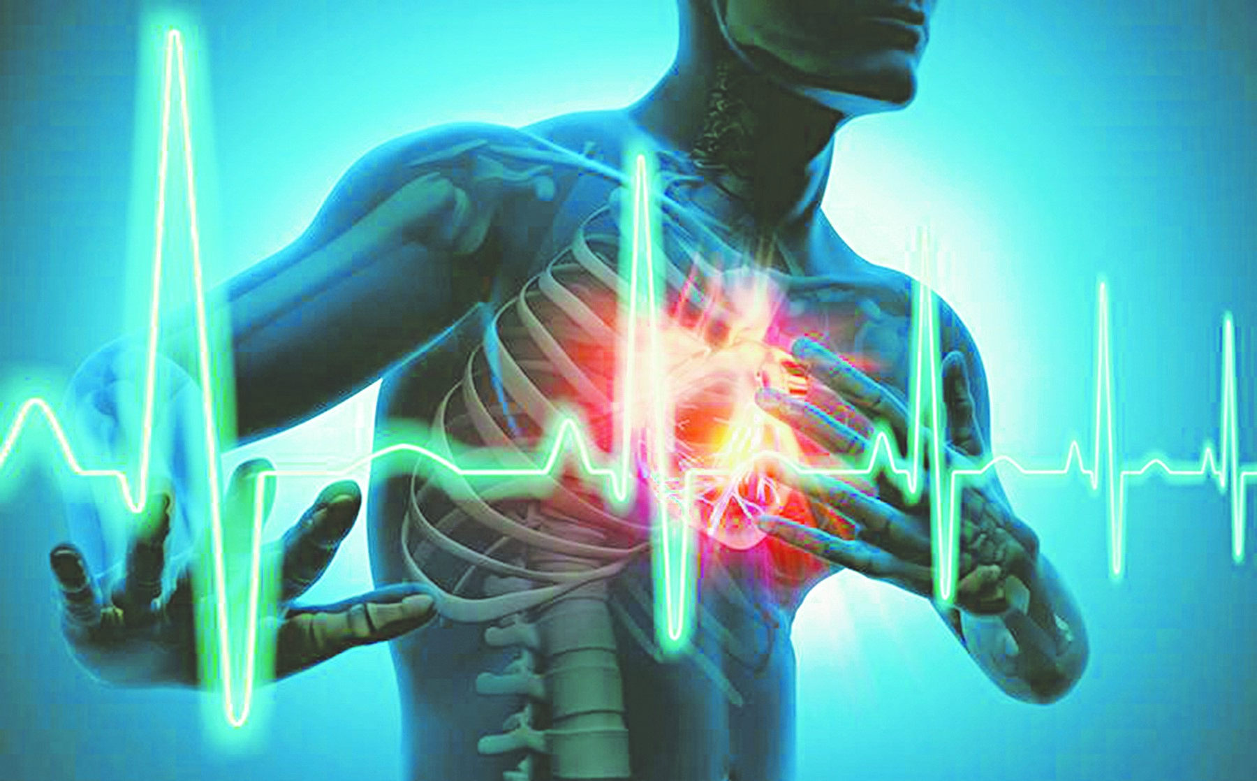 Rối loạn nhịp tim, bệnh nguy hiểm thường bị bỏ qua - Ảnh 1.