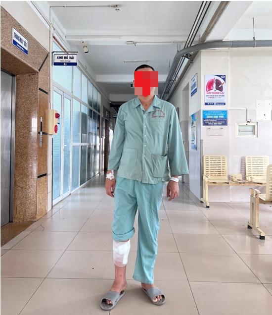 Thanh niên suýt mất chân vì tự ý dùng thuốc Đông- Tây y chữa bệnh khớp - Ảnh 2.