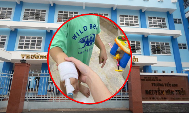 Vụ học sinh bị đánh gãy ngón tay: Phụ huynh phản ánh có dấu hiệu không minh bạch khi xử lý viên chức - Ảnh 4.