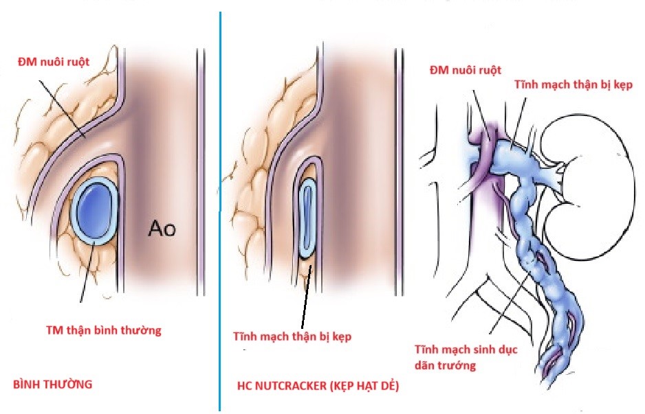 Cô gái mắc bệnh hiếm gặp khiến thể trạng gầy yếu, đau bụng âm ỉ kéo dài - Ảnh 3.